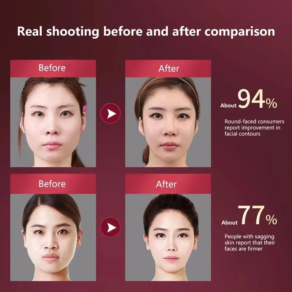 YTH SKN LED Photon Therapy Facial Slimming & Lifting Device